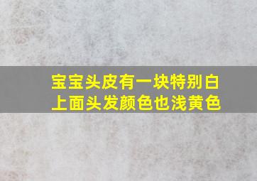 宝宝头皮有一块特别白 上面头发颜色也浅黄色